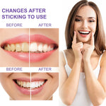 Charger l'image dans la galerie, PÂTE BLANCHISSANTE™Glory Smile.mettre  fin à des mauvais haleine et dents jaunes
